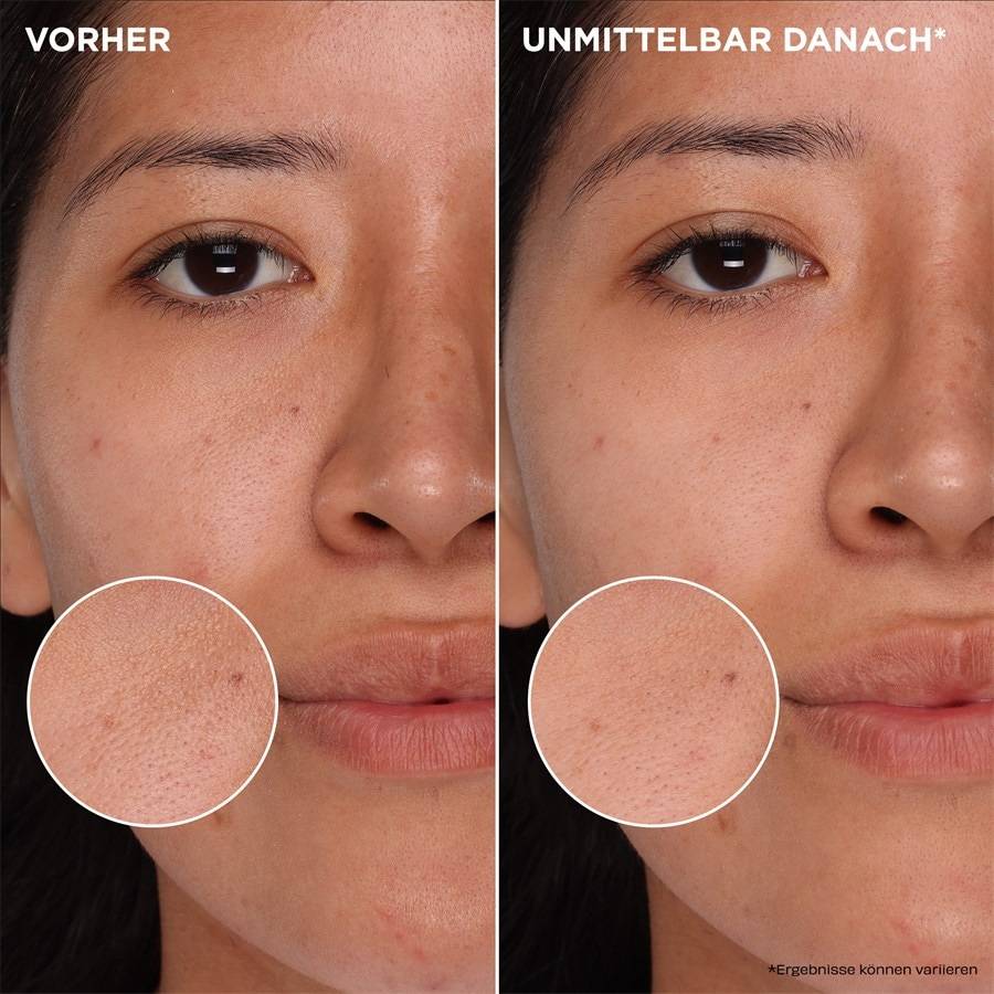 Benefit The POREfessional