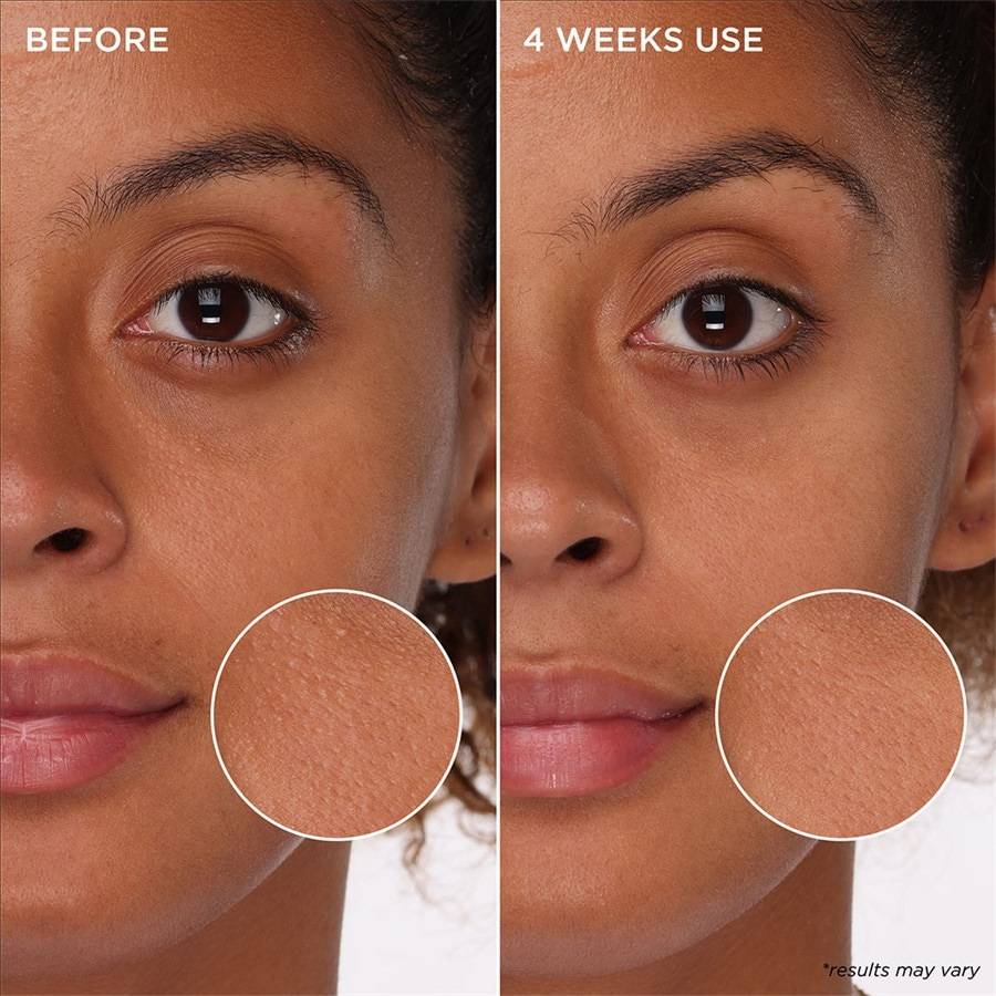 Benefit The POREfessional