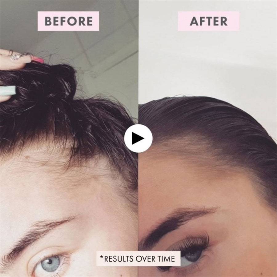 BondiBoost Spray