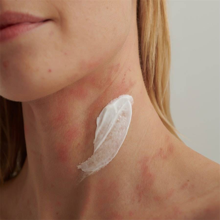 DADO-SENS EXTRODERM