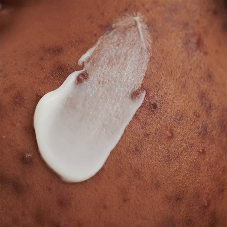 DADO-SENS PURDERM
