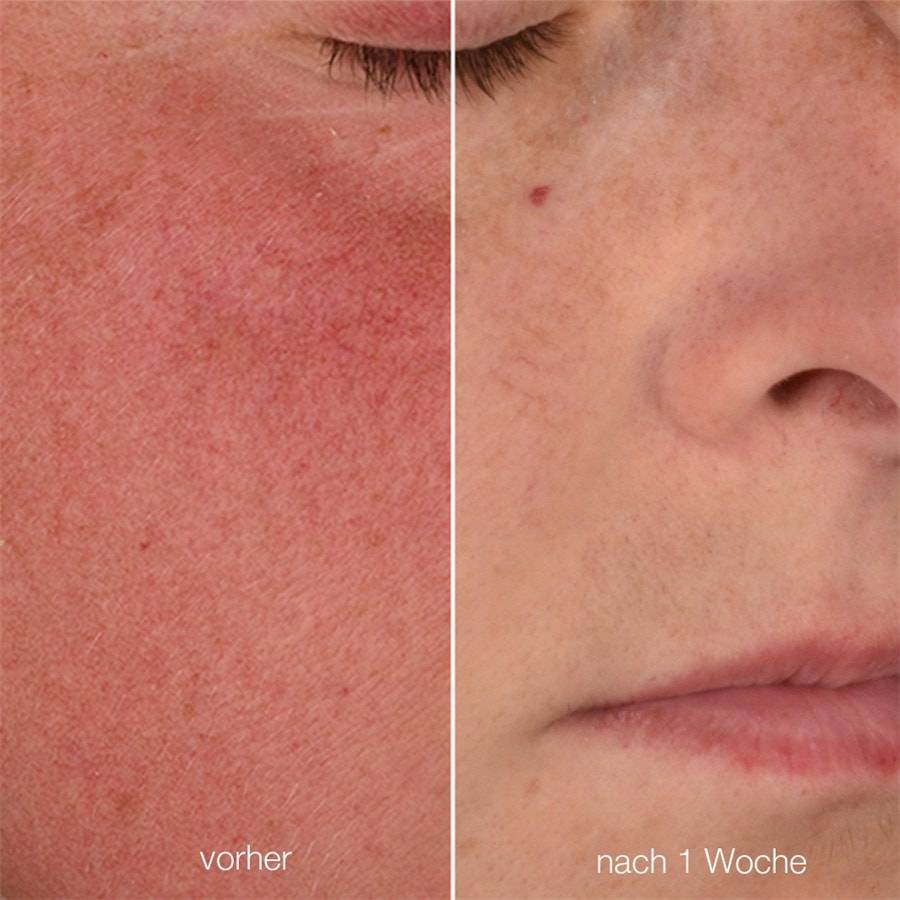 Dermalogica UltraCalming