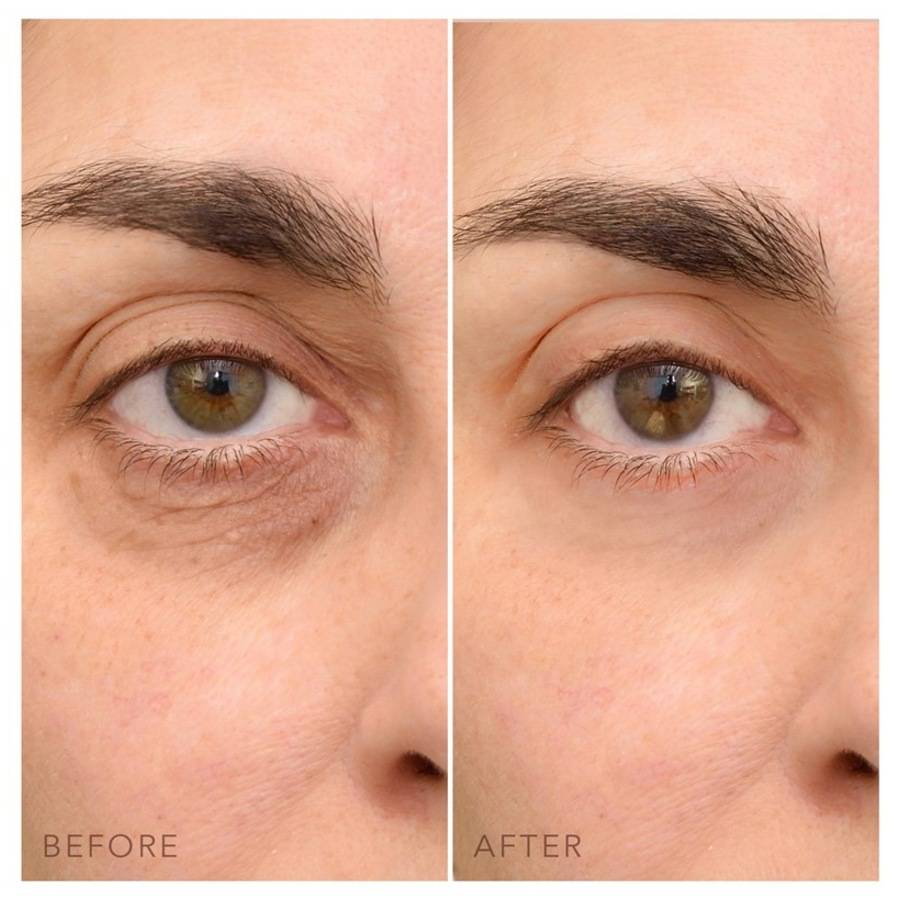 Foreo Augen