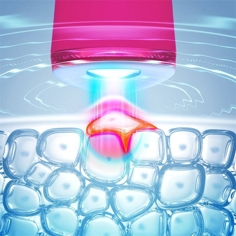 Foreo ESPADA 2
