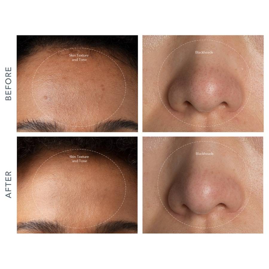 Foreo Reinigungsprodukte