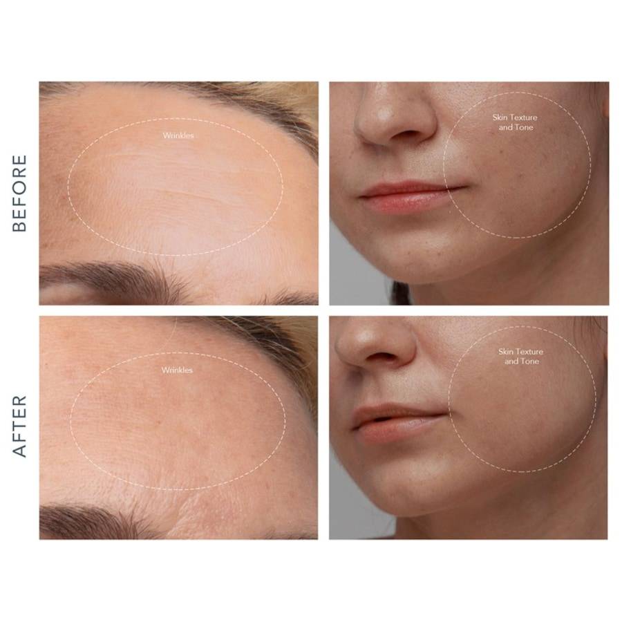 Foreo Reinigungsprodukte