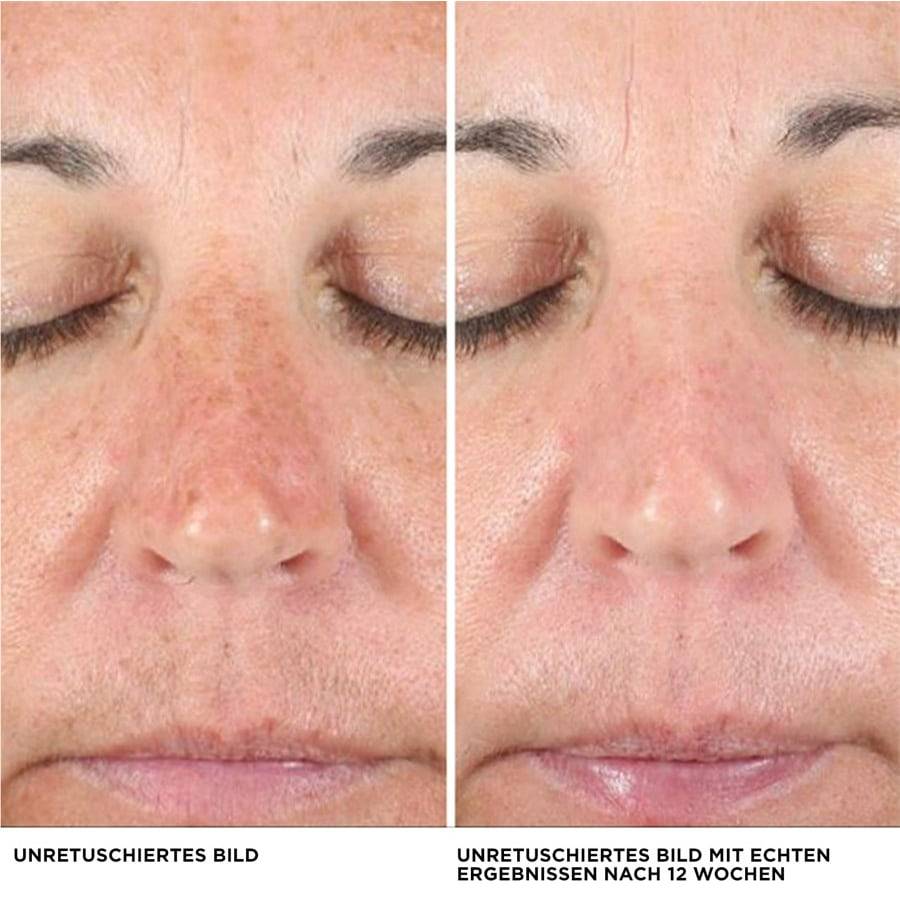 It-Cosmetics Concealer