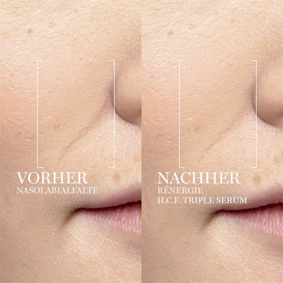 Lancome Serum