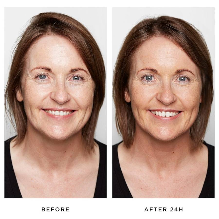 Pestle-Mortar Anti-Ageing