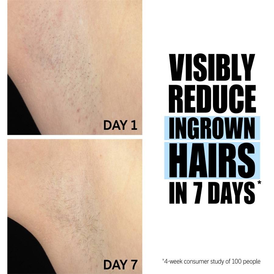 The-INKEY-List Peeling