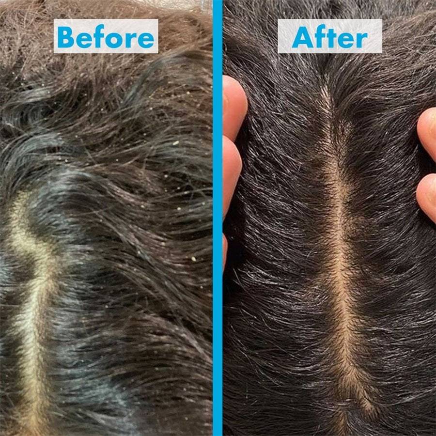 Umberto-Giannini Scalp Restore
