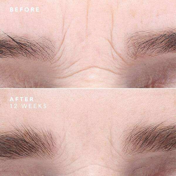 BIOEFFECT EGF Serum 15ml