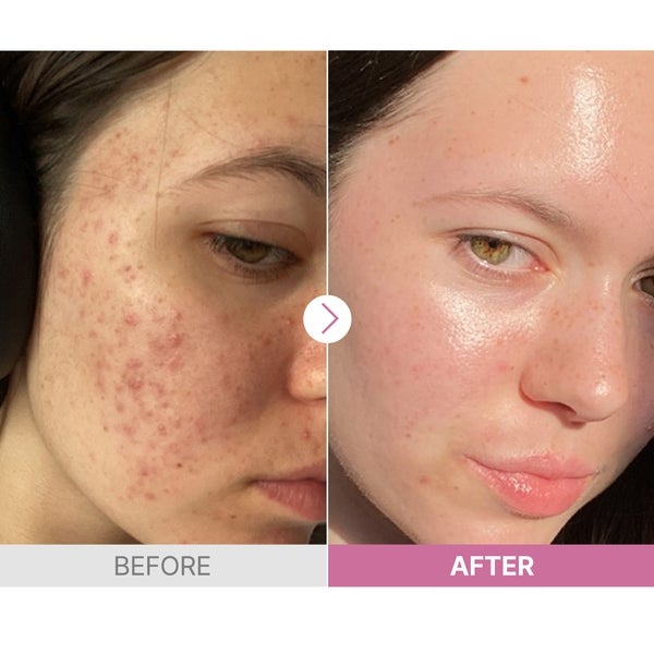 COSRX The Niacinamide 15 Serum 20ml