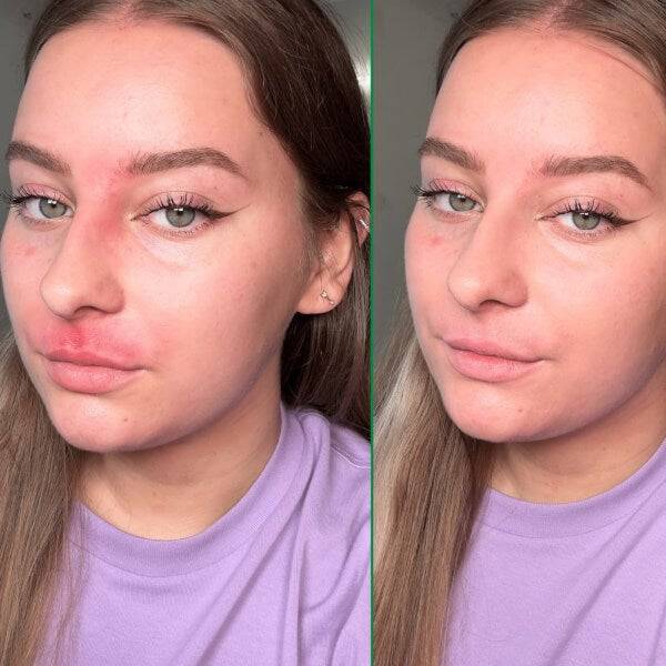 Dr.Jart+ Cicapair Tiger Grass Color Correcting Treatment 15ml