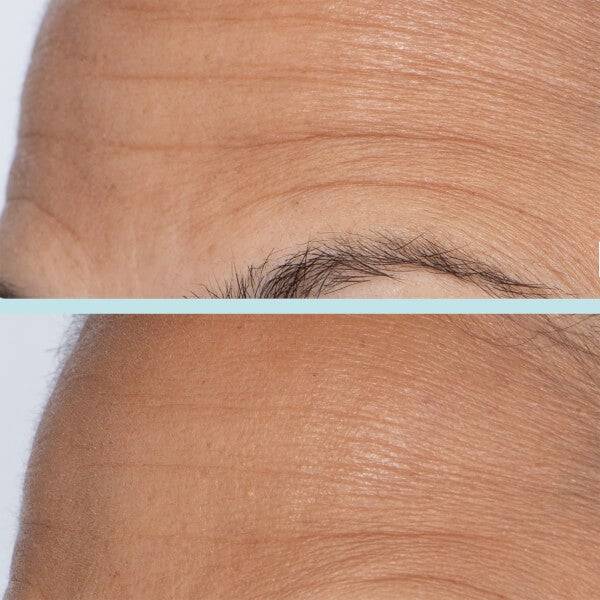 First Aid Beauty Bounce-Boosting Serum With Collagen + Peptides 30ml