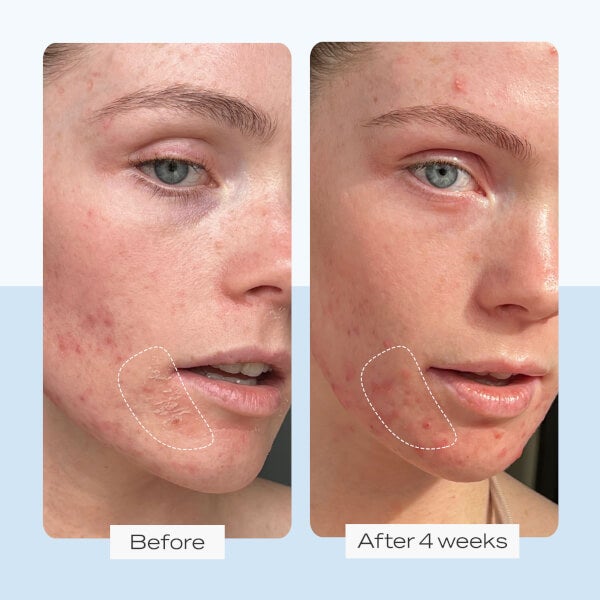 First Aid Beauty Ultra Repair Cream 170g