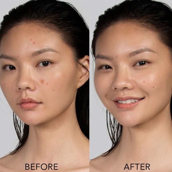 FOREO ESPADA 2 Device - Pearl Pink