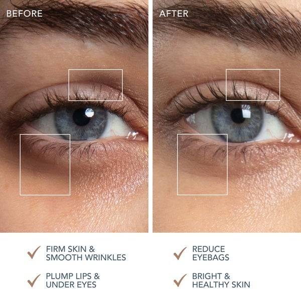 FOREO Supercharged Eye And Lip Contour Booster 3.5ml X 3