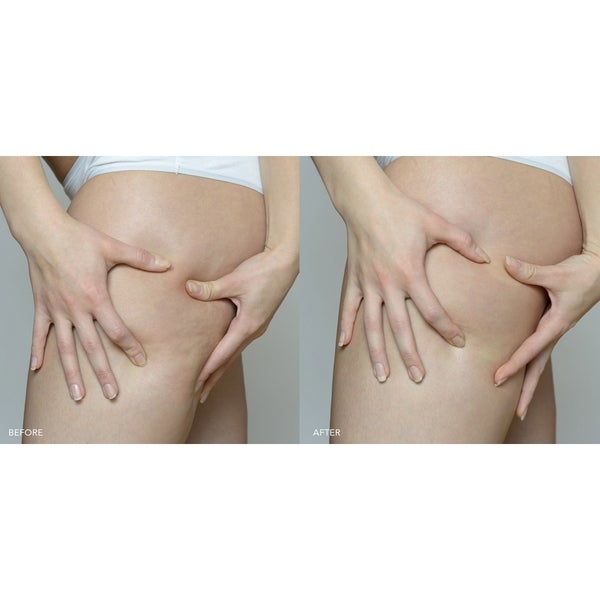 FOREO Supercharged Firming Body Serum 100ml