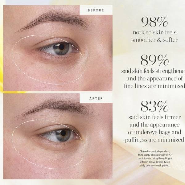 Kora Organics Berry Bright Vitamin C Eye Cream 15ml