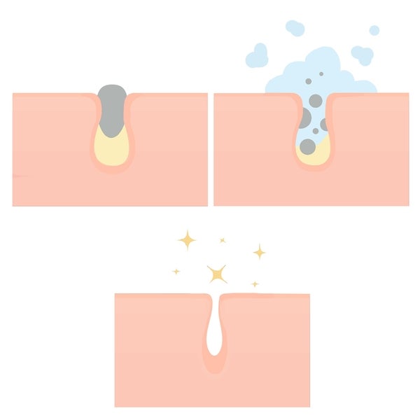 MAGNITONE London SteamAhead2 Hydrating Facial Nano Steamer