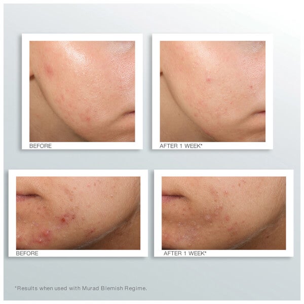 Murad Outsmart Blemish Clarifying Treatment 50 Ml