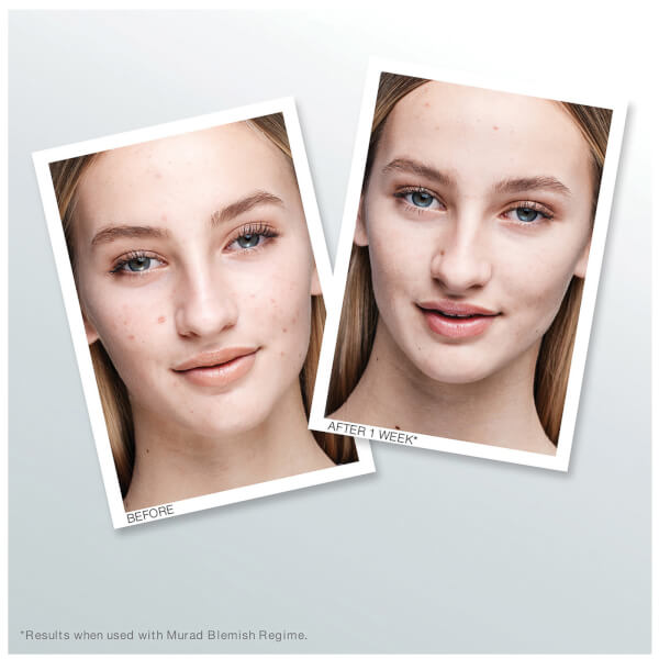 Murad Outsmart Blemish Clarifying Treatment 50 Ml