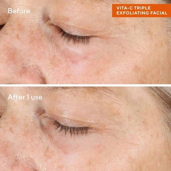 Murad Vitamin C Triple Exfoliating Facial Peel 76,72 Ml