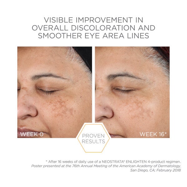 Neostrata Enlighten Pigment Controller Cream With Retinol & Vitamin C 50ml