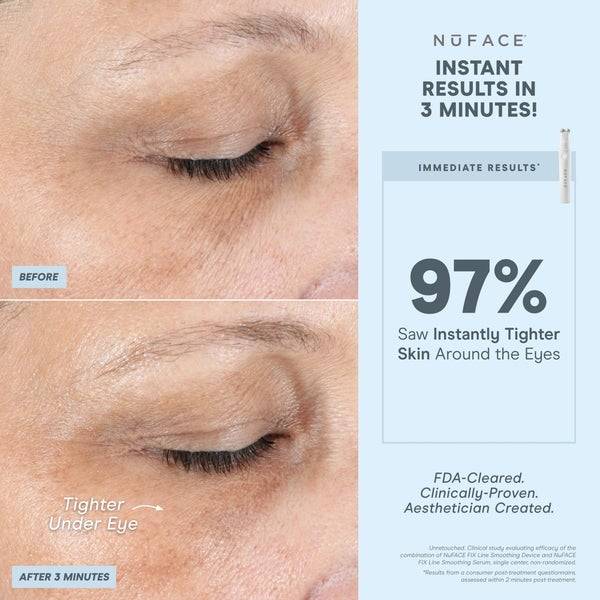 NuFACE FIX Line Smoothing Device