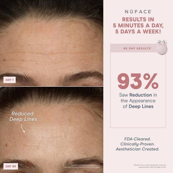 NuFACE® Mini Starter Kit - Violet Dusk