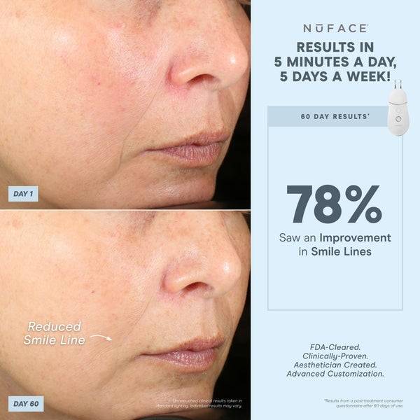 NuFACE Trinity+ And Effective Lip And Eye Attachment Set