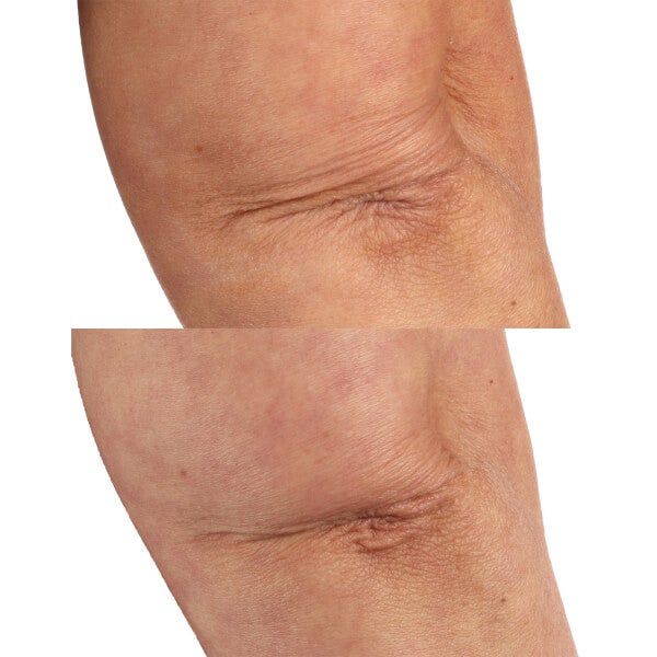 Perricone MD FG Essential Fx Acyl-Glutathione Chia Body Oil 4oz FG