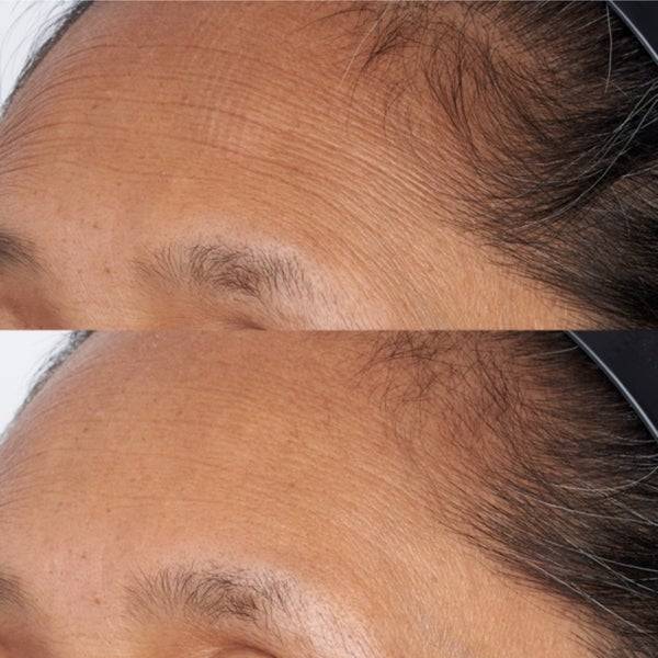 Perricone MD FG High Potency Hyaluronic Intensive Hydrating Mask 59ml