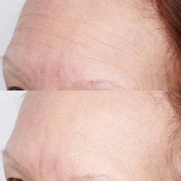 Perricone MD FG High Potency Hyaluronic Intensive Hydrating Mask 59ml