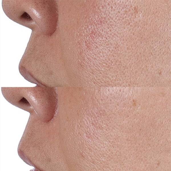 Perricone MD HP Face Finishing And Firming Toner 4 Oz FG