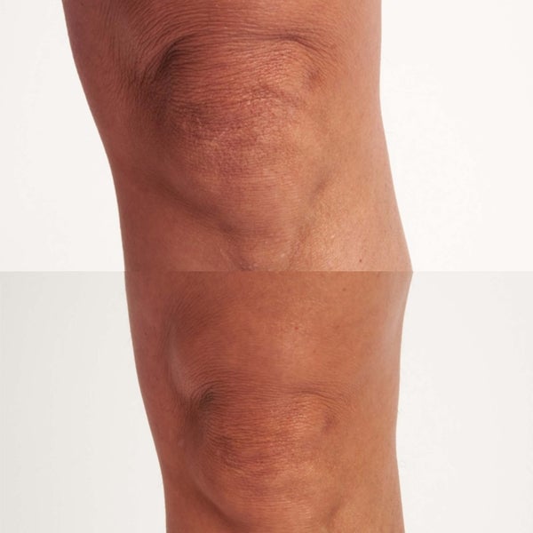 Perricone MD HP Hyaluronic Intensive Body Therapy 6 Oz FG