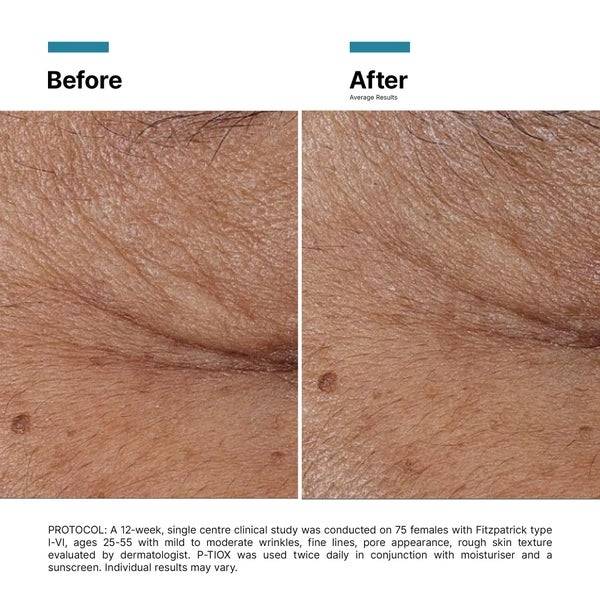 SkinCeuticals P-Tiox Neuro-Peptide Serum 30ml