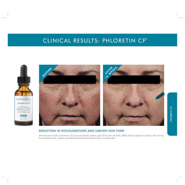 SkinCeuticals Phloretin CF Antioxidant Serum For Normal, Combination, Discolouration-Prone Skin Types