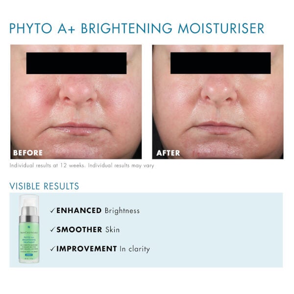 SkinCeuticals Phyto A+ Brightening Treatment 30ml
