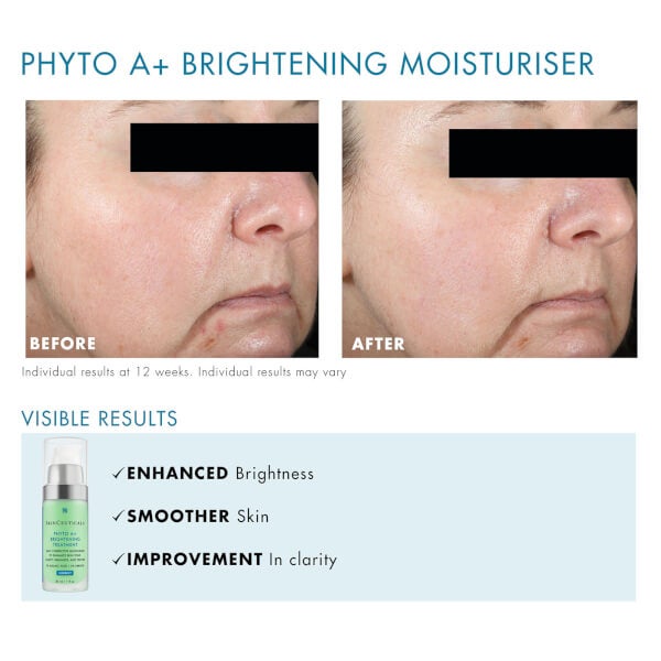 SkinCeuticals Phyto A+ Brightening Treatment 30ml