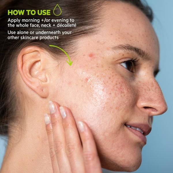 SVR Laboratoires Sebiaclear Serum For Mature Acne 30ml