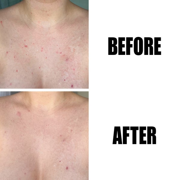 The INKEY List Glycolic Acid Exfoliating Body Stick 45g