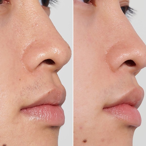 The Inkey List PHA Toner