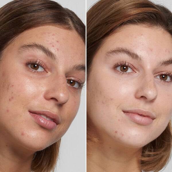 The INKEY List Salicylic Acid Cleanser 150ml