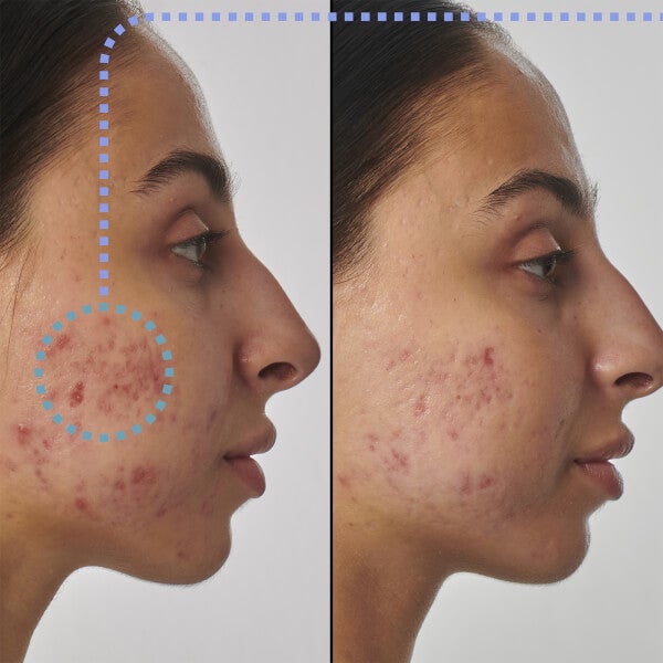 The INKEY List Super Solutions 1% Retinol Serum 30ml