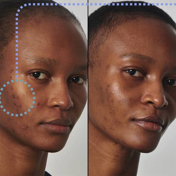 The INKEY List Super Solutions 20% Niacinamide Serum 30ml