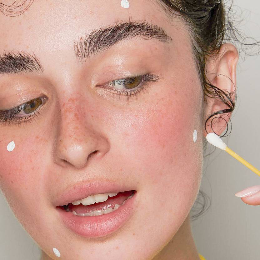 Acnemy Dryzit® (30ml)