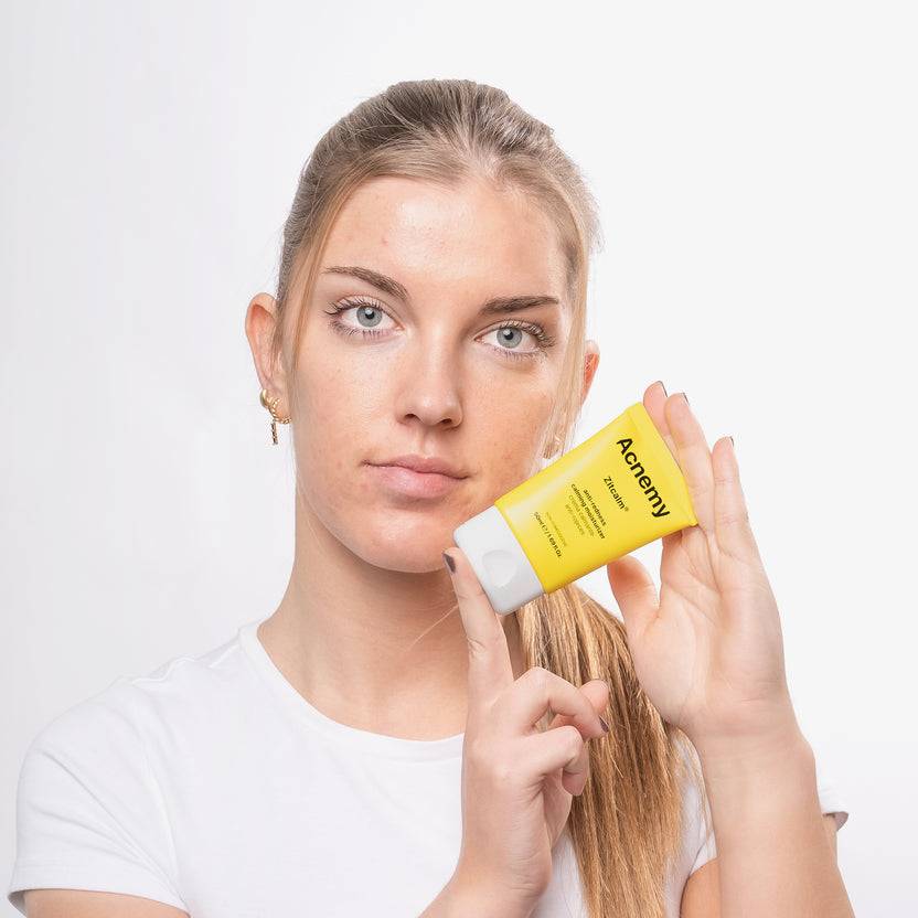 Acnemy Zitcalm Moisturizer (50ml)