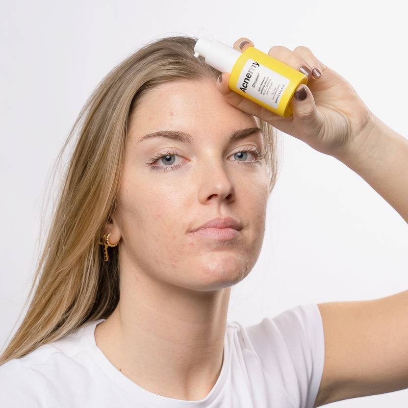 Acnemy Zitcalm Serum (30ml)